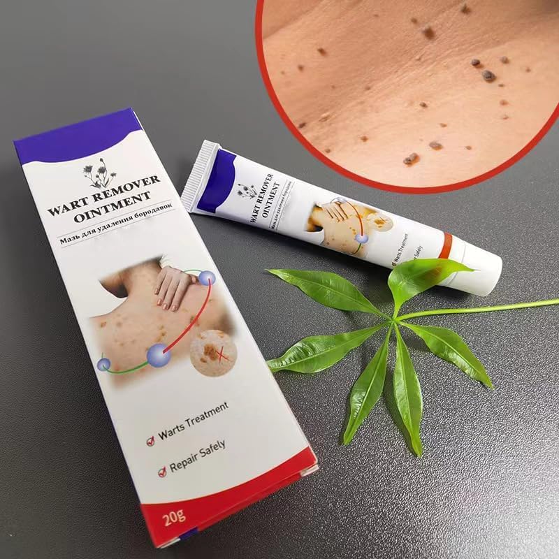 ๐๐๐ซ๐ญ๐ฌ ๐๐๐ฆ๐จ๐ฏ๐๐ซ ๐๐ข๐ง๐ญ๐ฆ๐๐ง๐ญ